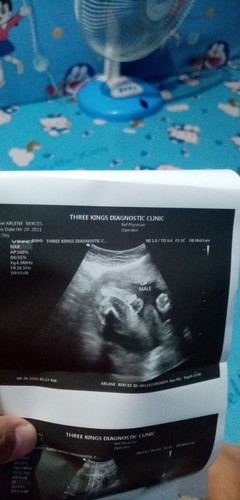 Sure npo ba lalake yung nsa ultrasound po salamat po sa sagot at normal lang po ba yung ultrasound k