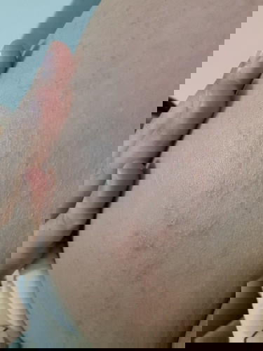 สอบถามค่ะ คุณแม่ท่านใดเป็นอาการแบบนี้มั้งคะ