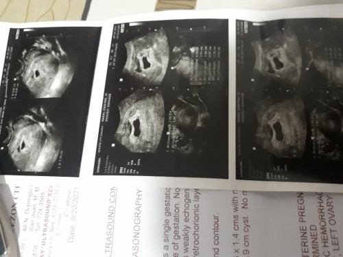 2nd transV ko na po ngaun,ang alam ko po 9w na,tpos po ung result ko now 6w2d,tpos wla padin bby,