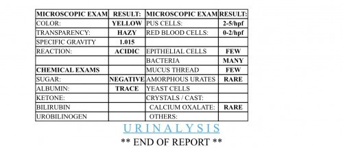 Urinalysis