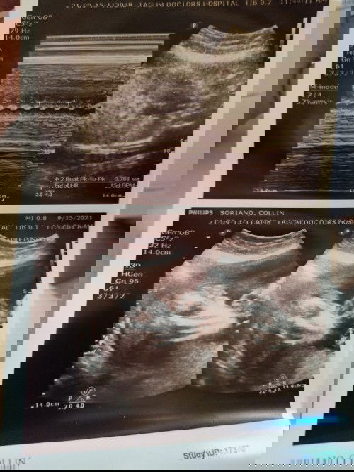 d ko kasi makita ng malinaw huhuhu san po ba ang kamay at paa jan?