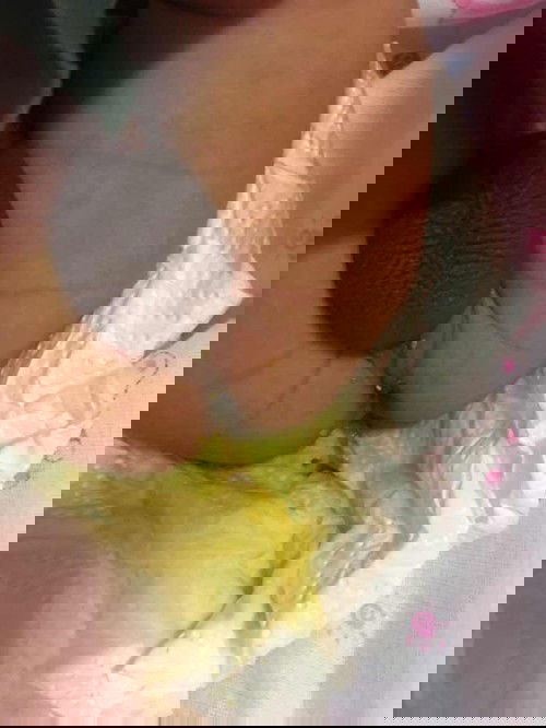 ลุกคนแรกน้องได้3วันแล้วบางทีเอาเข้าเต้าบ้างแต่กลัวน้องไม่อิ่มเลยซื้อนมดูแลคมาให้กินถ่ายแบบนี้ปกติมั๊ยค่ะ