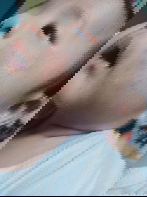 Red dots paano mawala