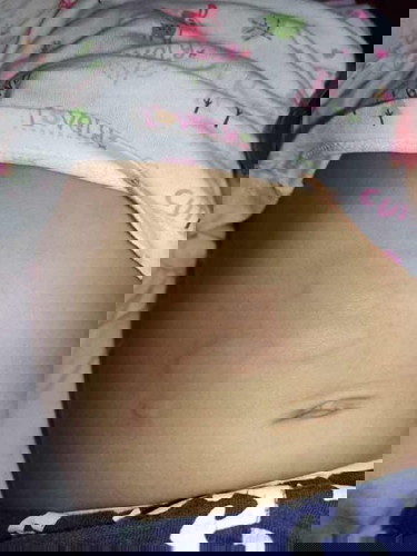 Allergy po ba or may something's wrong na?