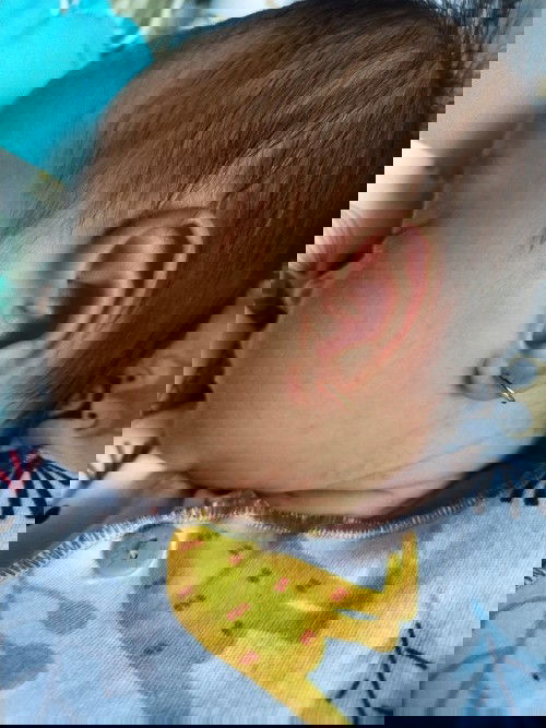 Rekomendasi krim ruam buat baby