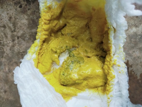 อึแบบนี้ปกติมั้ยคะ