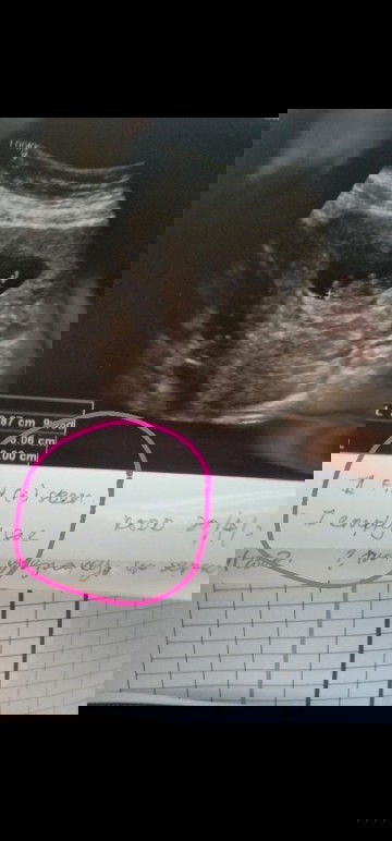 Kenangan semalam scan baby..