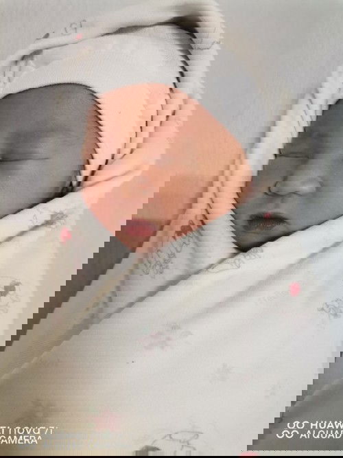 Paninigas at pananakit ng dede