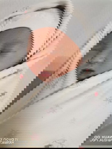 Paninigas at pananakit ng dede