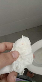 มีเลือดออก