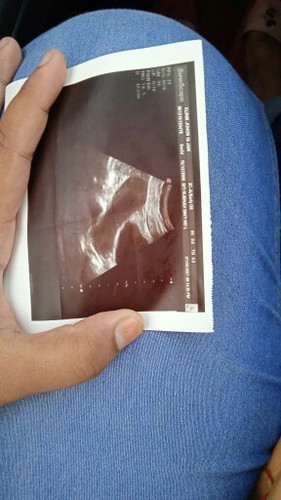 Saya nk tnya la Sya MMG jenis priod dri zaman dlu sebulan 2kali priod... Tp terakhir Sya priod 1.8-9