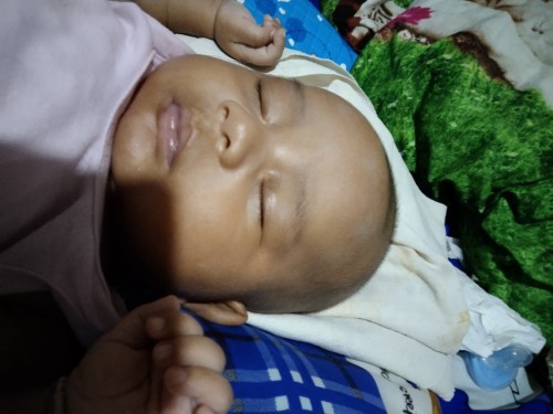 Mau tanya dong bun knpa wjh anak saya putihnya gk rata ya bun syg dibwah bibir sma diatas bibir ya