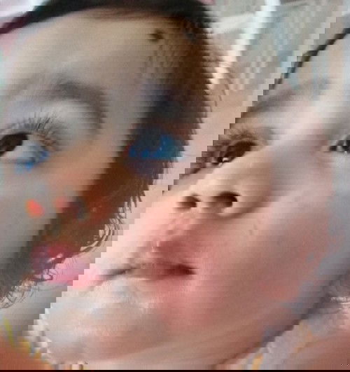 Baby rashes on cheeks