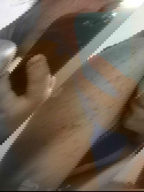 เเม่บ้านไหนมีเป็นหนักกว่านี้ไหมคะ