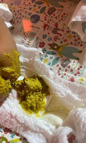 กินนมผงได้8วันถ่ายยาก