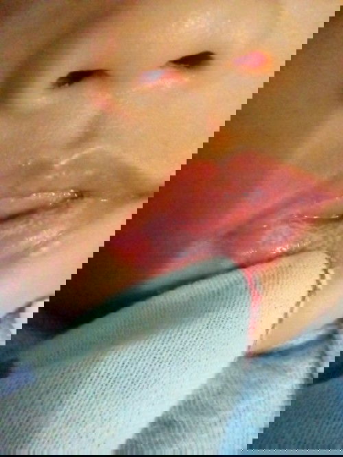 Putih2 di mulut  bayi 2 bln setengah