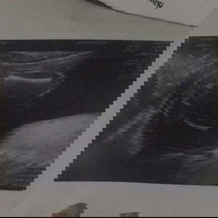 ทีมมกราลูกสาวหรือลูกชาย