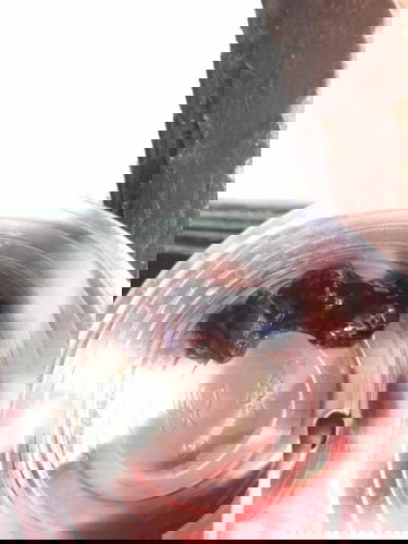 มีก้อนเลือดออกทางช่องคลอด