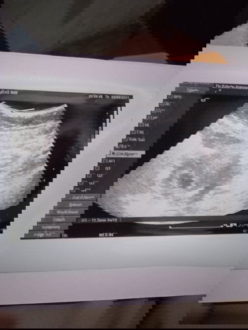 Ada yg sama engga 4w 1d baru kelihatan kantungnya aja.