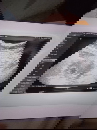 Ada yg sama engga 4w 1d baru kelihatan kantungnya aja.