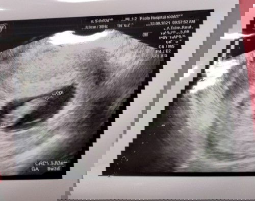 ขอดูภาพอัลต้าซาวด์