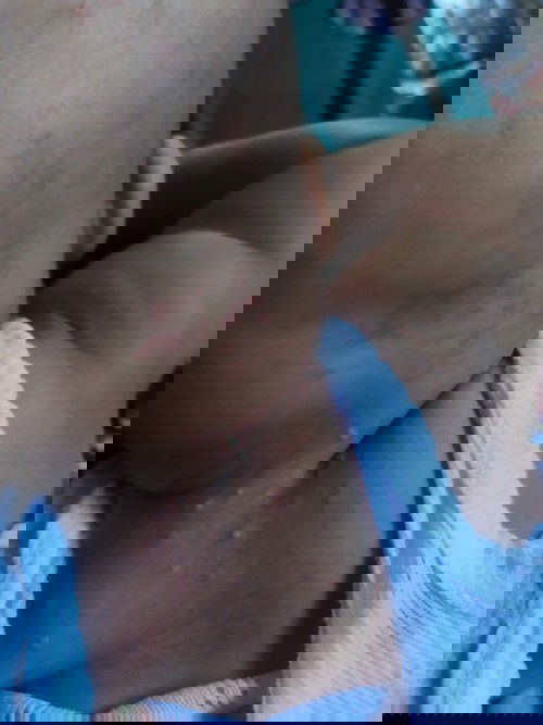 Obat mlenting bayi 2bulan