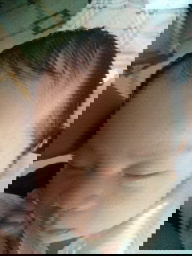 Hi po PA help naman po aq may mga mapupula sa balak ng baby q normal po ba un
