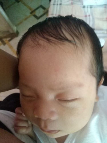 Hi po PA help naman po aq may mga mapupula sa balak ng baby q normal po ba un