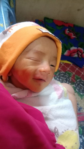 Bund sharing yuu
aku lahiran prematur,diusia kandungan 35week,hpl 14okt dede launching 8september