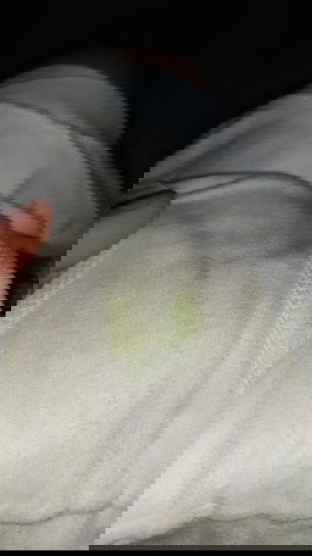 Is this normal during pregnancy?