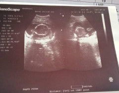 19weeks na po baby ko