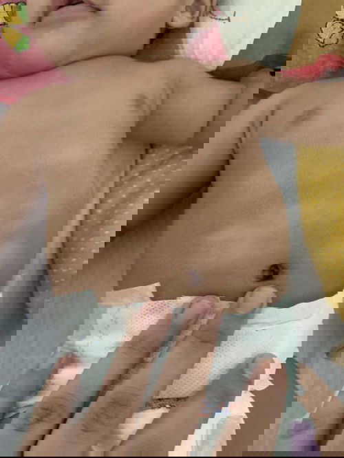 Help with baby skin!