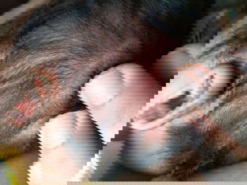 สอบถามหน่อยครับ มีผื่นหรือผดขึ้นบริเวณศีรษะลูก