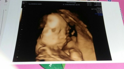 Usg baby 6bln