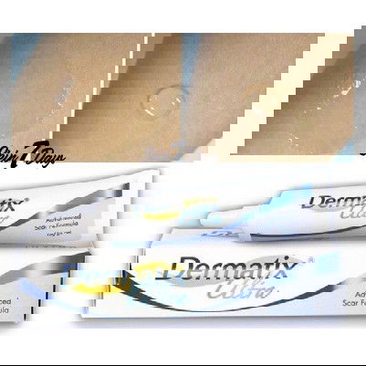 Dermatix Ultra