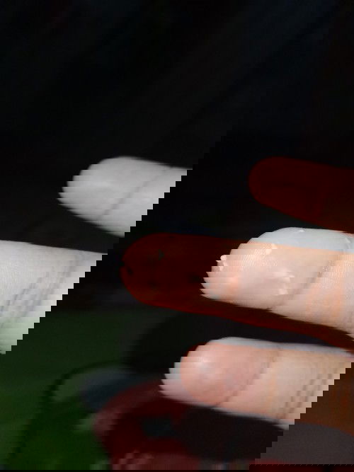 Keputihan banyak 37,5 pregnant