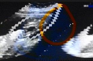 Ada yg waktu di usg kemungkinan 60% cowok?