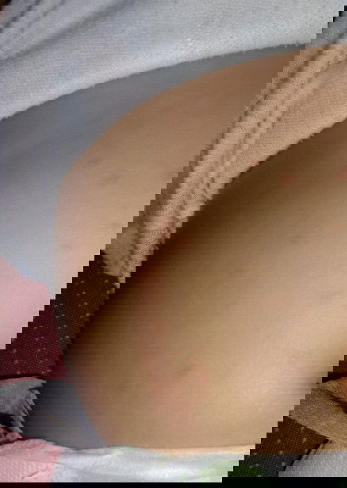 Seputar elergi pada bayi