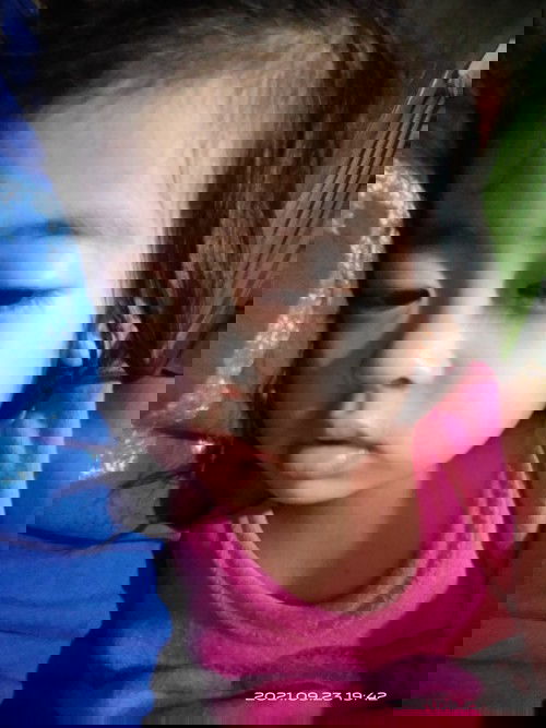 Antibiotics For 2 years old
Ubo at Sipon