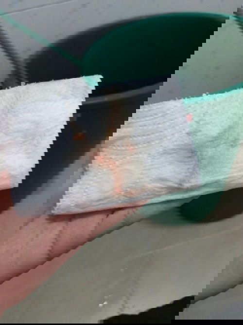 เจ็บเตือนมาอีกรึป่าวลูก