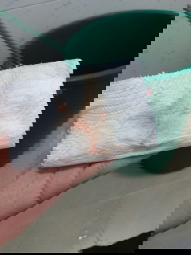 เจ็บเตือนมาอีกรึป่าวลูก