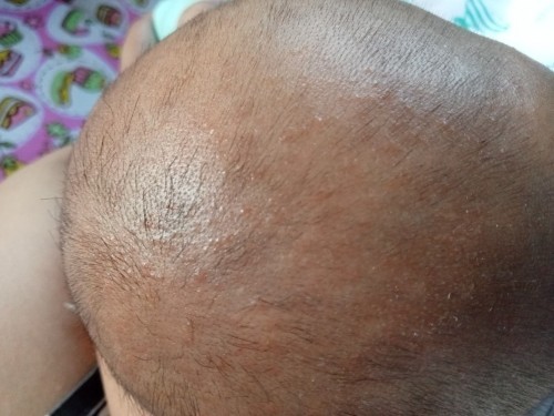 สอบถามเรื่องลูกน้อยค่ะ