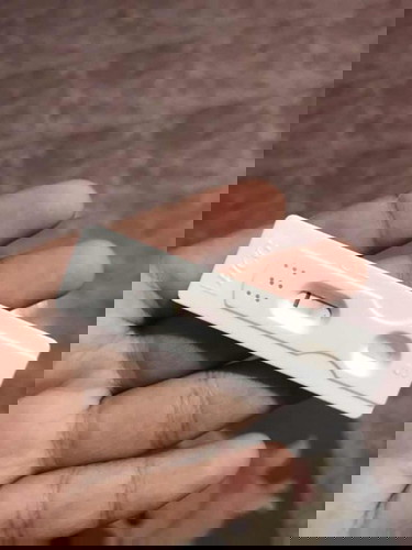 ฝังเข็มยาคุม