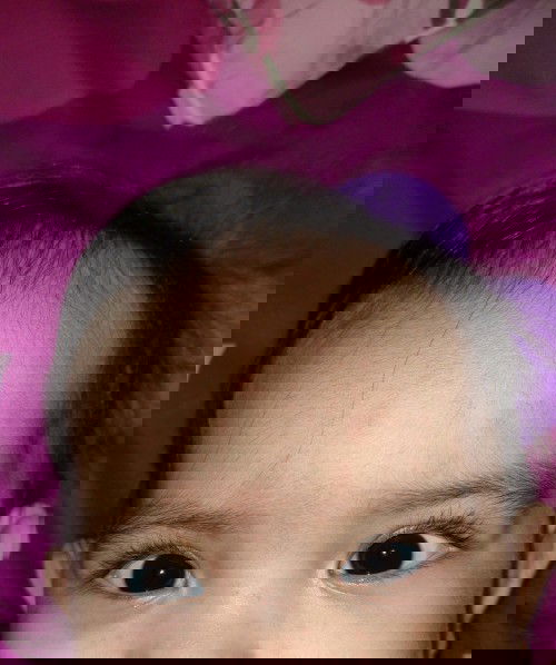 Anak sy panas demam 2 mlm, setelah panas demamnya turun muncul bercak sprti ini. Ada yg tau itu knp?