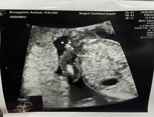 ลูกสาวหรือลูกชาย