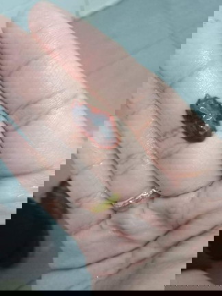 ตรวจว่าท้อง ตรวจเอง 3 อันขึ้น2ขีด
แต่หลังจากเลือดออก ตรวจอีกครั้งขึ้นขีดเดียว