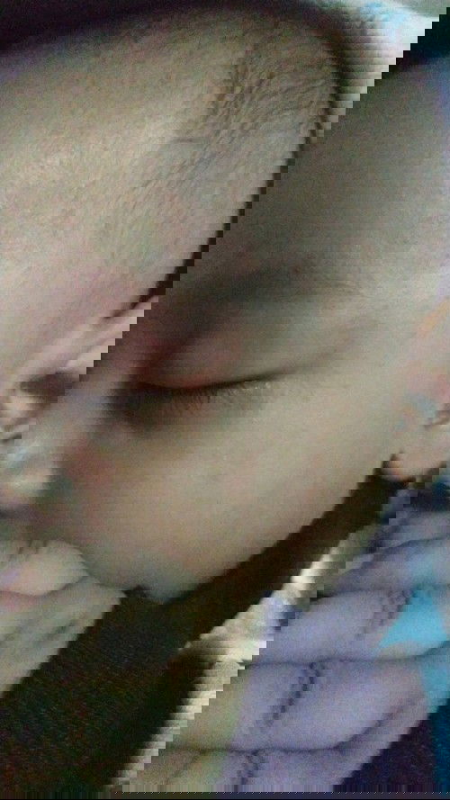 Kenapa wajah baby ku merah mrintisi