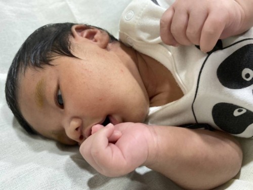 ลูกเป็นผดผื่นใช้ครีมตัวไหนดีช่วยแนะนำหน่อยค่ะ