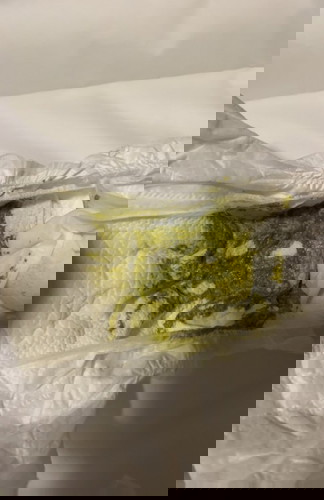 Breastmilk- Green stool