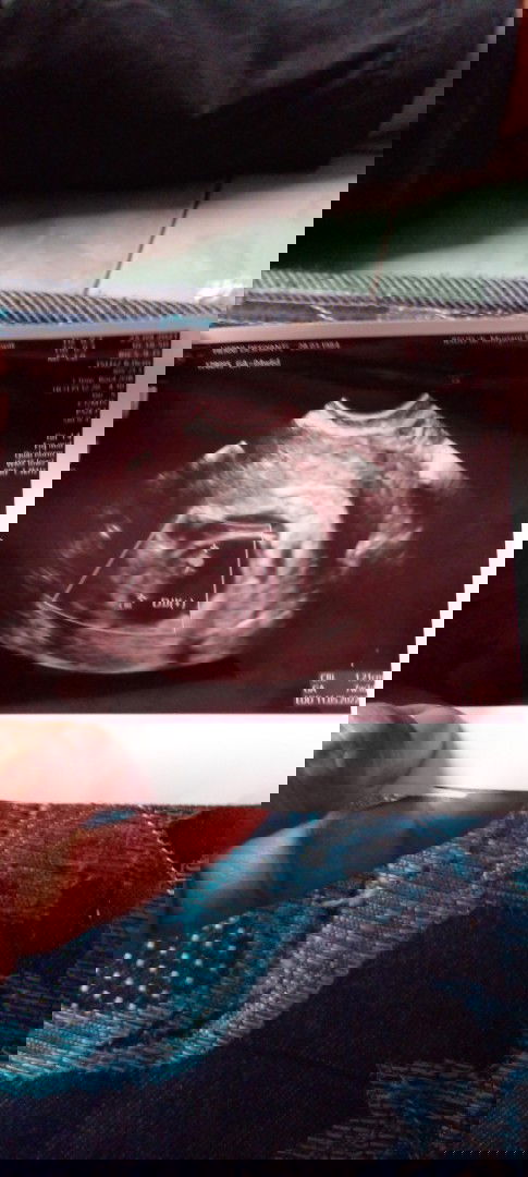 Terimksh doanya buat bunda2